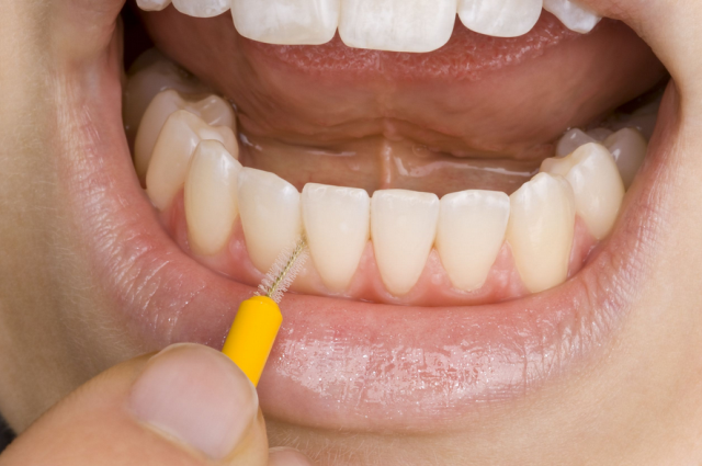 Pravilno čišćenje prostora između zubi petak