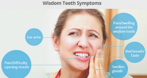 Umnjaci – zubi mudrosti ili zubi koji stvaraju probleme?