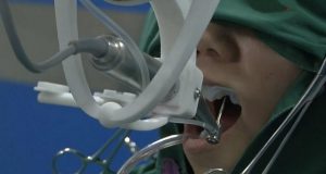 Robot – stomatolog