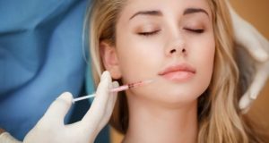 Postupak aplikacije hijaluronskih filera