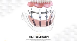 Tečaj Multi Plus Concept – Highlights