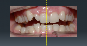 Modul 8 CS Orthoseminarsa – Asimetrije