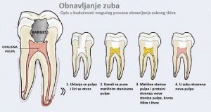 Matične stanice dentalnog porijekla