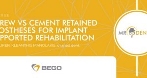 Tečaj “Screw vs Cement Retained Prostheses for Implant Supported Rehabilitation” – Bihać, 17.  april