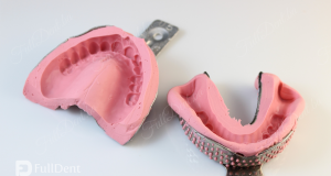 Materijali za uzimanje dentalnog otiska – IV dio