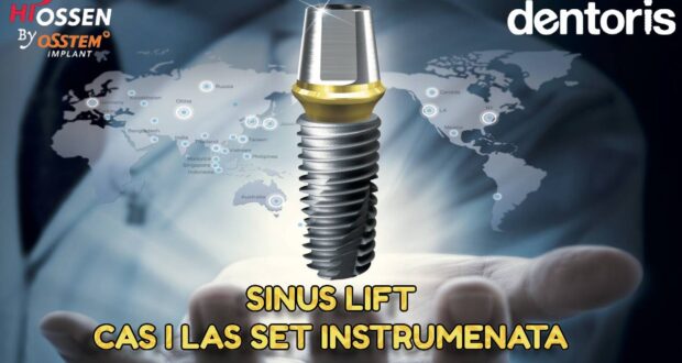 SINUS LIFT – CAS i LAS set instrumenata – Banja Luka, 11. novembar