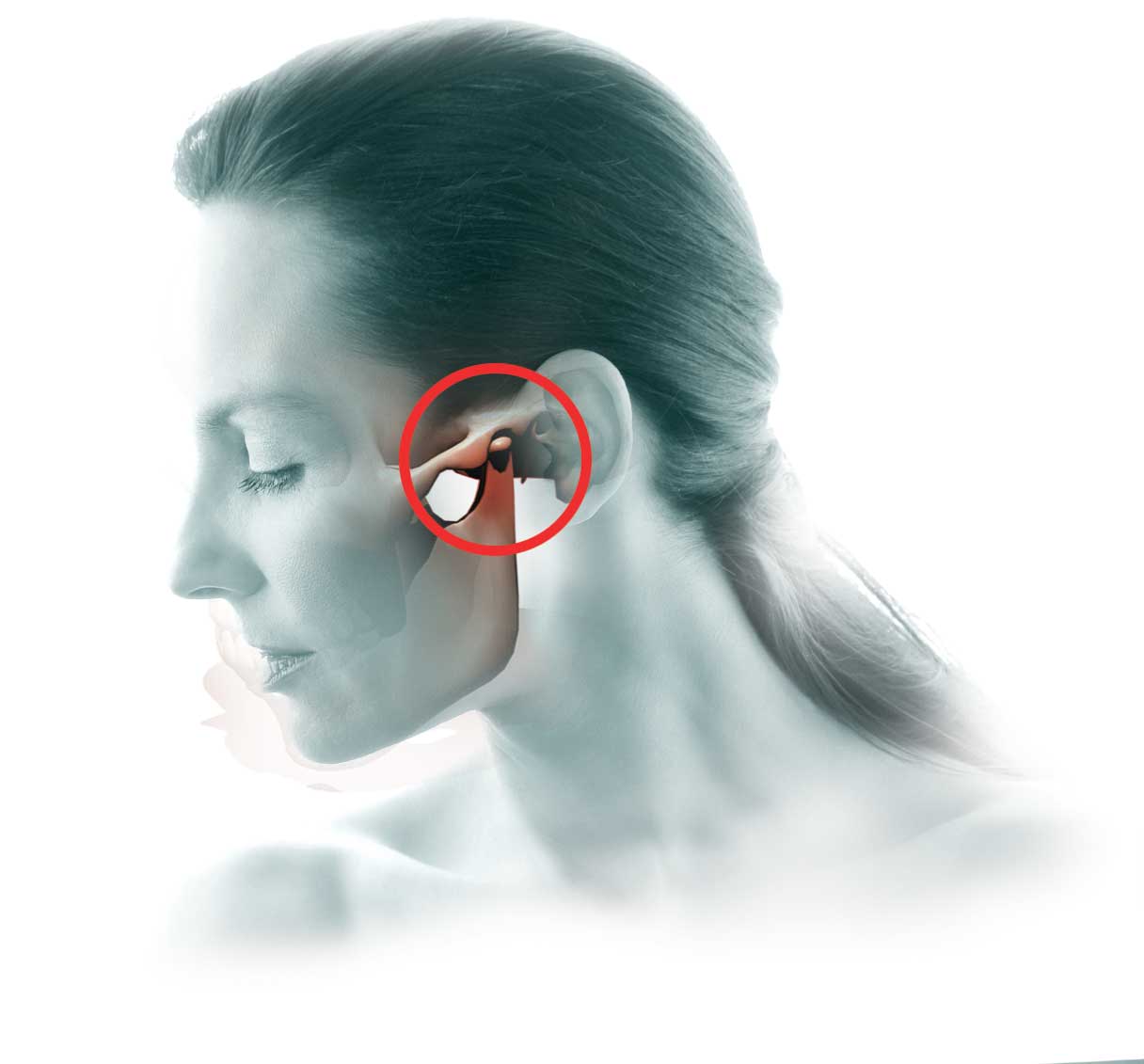 Disfunkcije TMZ-a (čeljusnog ili temporomandibularnog zgloba)