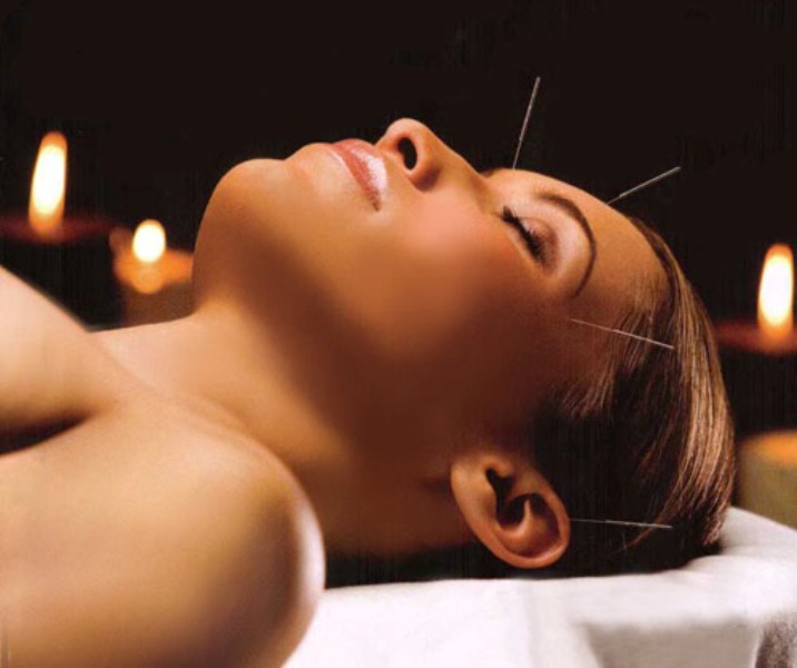 Može li se akupunktura primjeniti u stomatologiji?