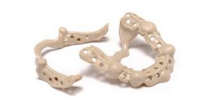 PEEK (Polyether ether ketone)