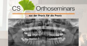 Modul 6 CS Orthoseminarsa – Impaktirani zubi u ortodonciji