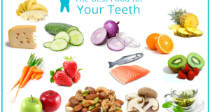 Hrana za zdrave zube – šta je dobro, a šta ne?