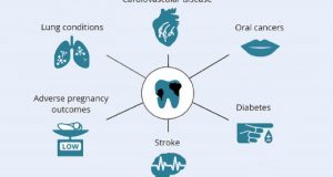 Značaj prevencije za oralno zdravlje