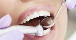 Terapija nekarijesnih oštećenja zuba