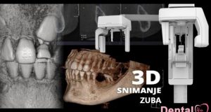 Digitalne rendgenske snimke zuba i vilice