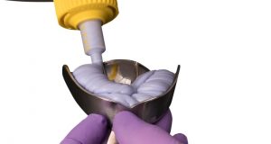 Materijali za uzimanje dentalnog otiska – III dio Vezivanje sintetičkih elastomera (polimerizacija)
