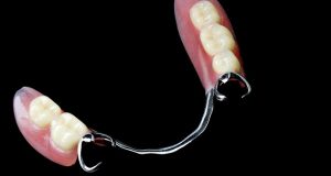 Parcijalne pločaste proteze